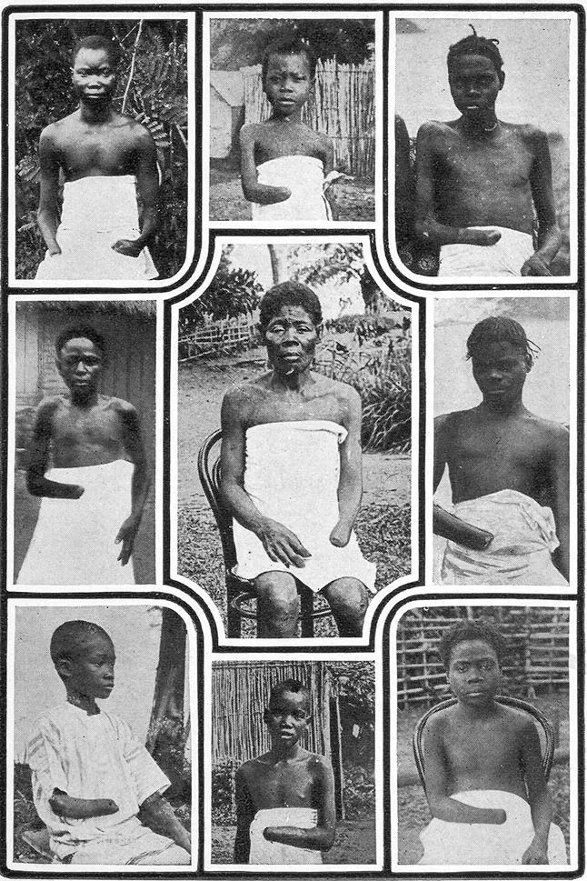 Kongolesische Opfer des Kautschukregimes von Leopold II., ca. 1904 Kongolesische Opfer des Kautschukregimes von Leopold II., ca. 1904